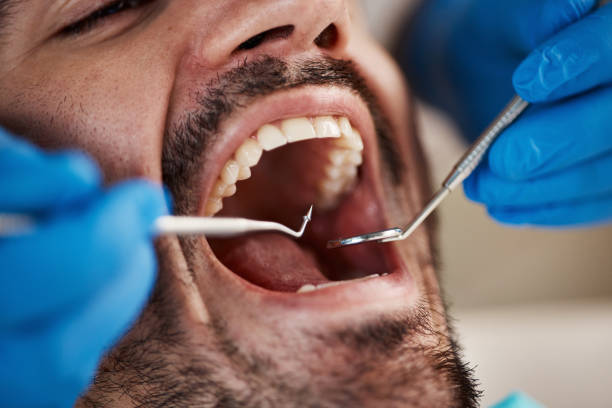 Best Wisdom Tooth Removal  in Benton Heights, MI